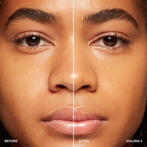 A woman with a clear, glowing face showing before and after skin improvement, focusing on smooth, bright skin and even tone.