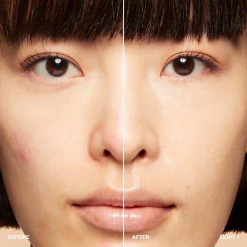 Split image of a woman's face showing before and after skin improvements.