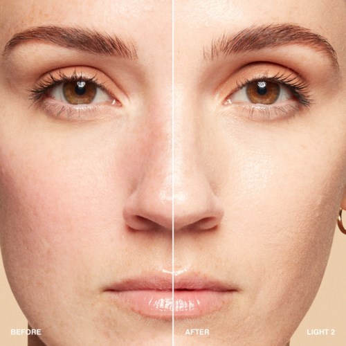 A woman shows clear skin improvement, with fewer spots and a brighter, smoother complexion after skincare treatment.