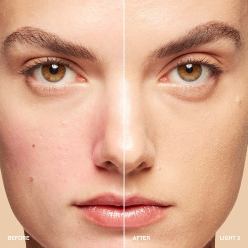 The image shows a young person's face with clear skin before and after skin treatment, highlighting improved skin texture.