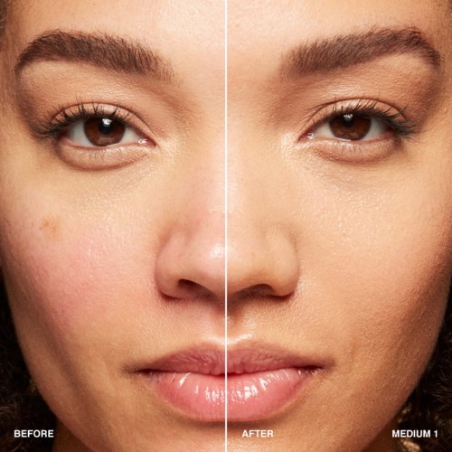 Comparison shows clear skin improvement, smoother and brighter with less redness and blemishes.