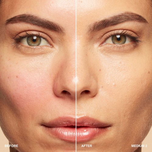 Side-by-side comparison of a woman's face before and after skincare treatment showing clearer, smoother skin.