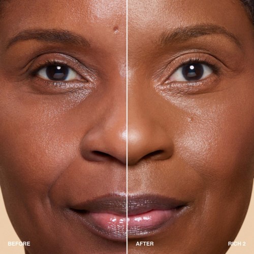 A face before and after showing clear skin improvement, with brighter, smoother, and more even skin tone.