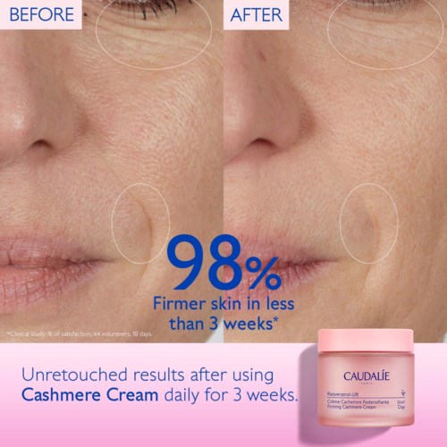 Before and after images showing skin improvement with Cashmere Cream in three weeks.