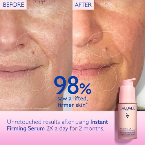 Before and after photos of skin showing reduced wrinkles and improved firmness after using serum for two months.