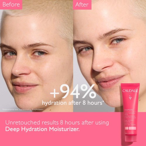 Before and after photos showing improved skin hydration after 8 hours using Caudalie moisturizer.