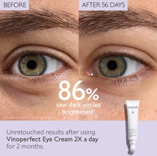 Before and after photos showing skin improvements around the eye after using Vinoperfect Eye Cream for 2 months.