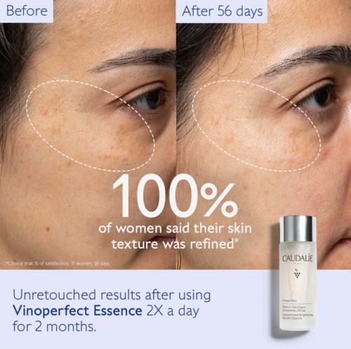 Before and after photos showing skin improvement near the eye from using Vinoperfect Essence for 2 months.