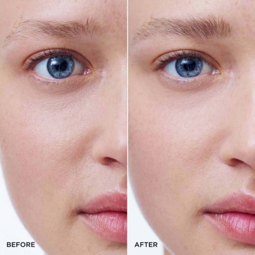 Side-by-side comparison of skin before and after skincare or makeup, focusing on face details and eye appearance.