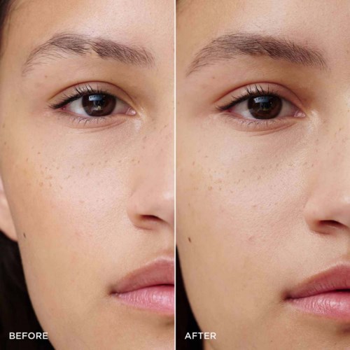 A side-by-side comparison of a woman's face shows improved skin, fewer freckles, and smoother skin after skincare.
