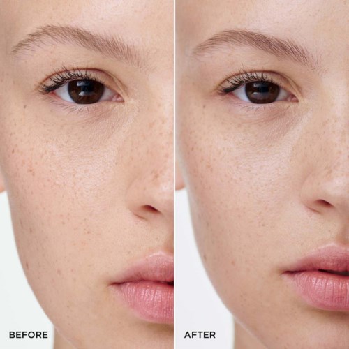 Side-by-side image showing face before and after skincare, highlighting clearer skin after treatment.