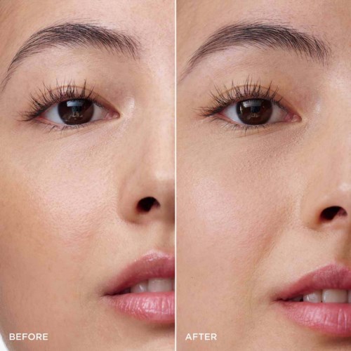 Comparison shows smoother, brighter skin after skincare, with reduced blemishes and improved tone.
