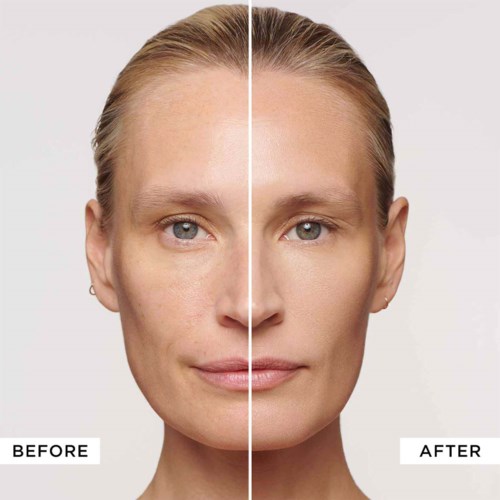 A woman's face split in two, showing skin issues on the left and clear skin on the right.