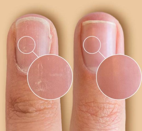 Vergelijking tussen droge en gezonde nagels, benadrukt netheid en nagelgezondheid.
