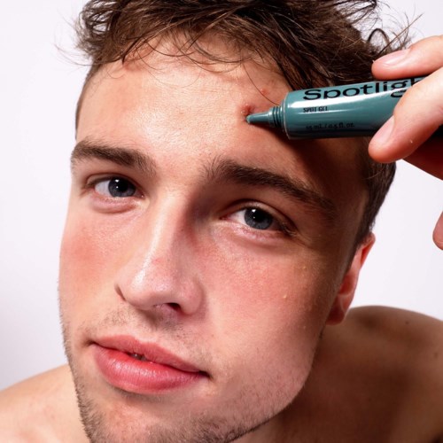 A young man is clearing his forehead with a marker or pen. He has light brown hair and blue eyes.