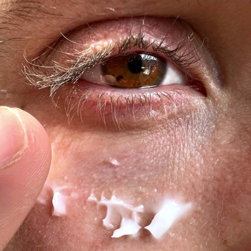 A close-up of an eye with skin, eyelashes, and a finger near the lower eyelid. Some cream or lotion is applied.
