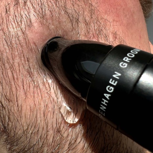A close-up of a person's face with a flashlight or microscope shining into their nose, showing skin and hair details.