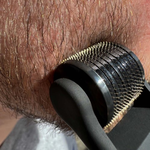 A close-up of a skin area with hair being shaved using a rotary electric shaver.