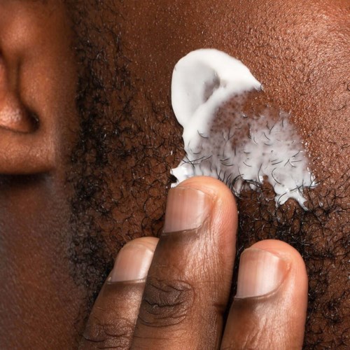 Finger applying white cream to dark skin near hair. Close-up of a skincare or cosmetic application process.