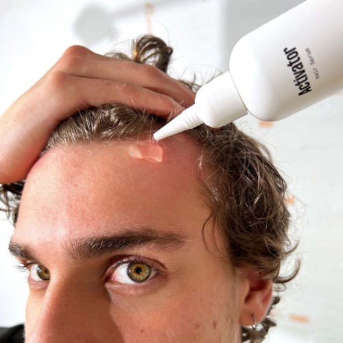 A person receives treatment on their forehead with a white bottle labeled 'Neurofactor.' The hand is pressing down on the hair.