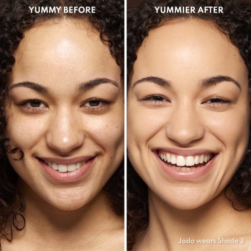 Before and after photos show a woman smiling, with clearer skin and brighter appearance in the second image.