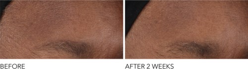 Dr Dennis Gross Advanced Retinol + Ferulic Overnight Wrinkle Treatment  30 ml