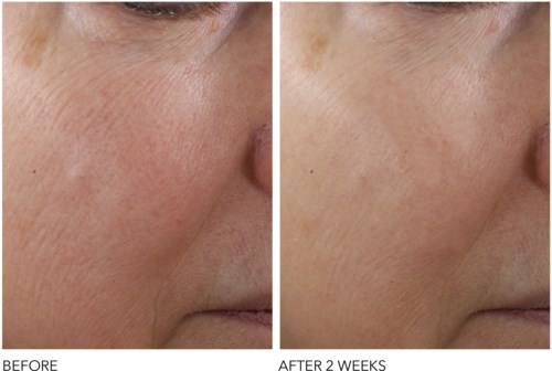 Dr Dennis Gross Advanced Retinol + Ferulic Texture Renewal Serum  30 ml