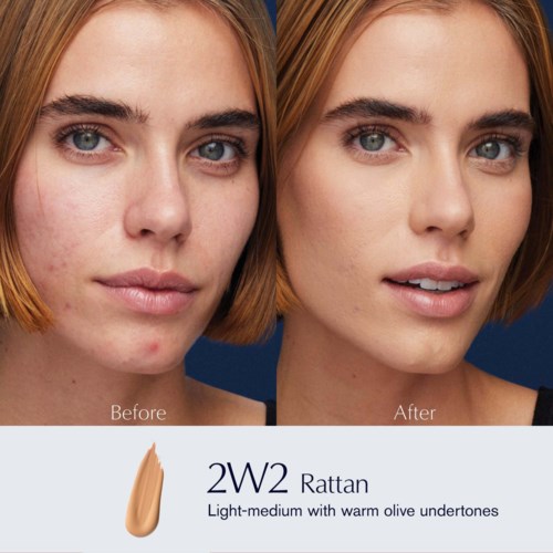 Vergleich einer Frau mit Akne vor und nach Hautpflege; Produktetikett für 2W2 Rattan Foundation.