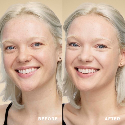 A woman with light hair smiling in two images, showing changes in her skin appearance.