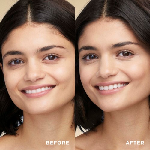 Two women, one before and one after skincare, showing clear, healthy skin and smiling faces.