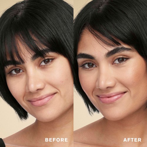 A woman shows before and after pictures, highlighting clearer skin and smoother complexion.