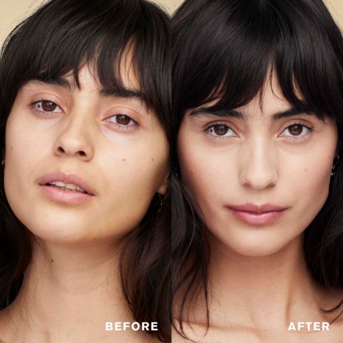 Two women with dark hair and similar features, one with slightly uneven skin, and the other with clear skin.