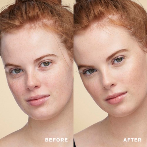 The image shows a young woman with red hair, before and after skincare, showing clearer skin and fewer freckles.