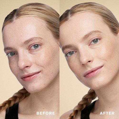 A before-and-after comparison of a young woman's face showing clear skin improvement.