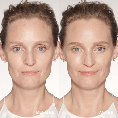 Nebeneinander-Bilder zeigen eine Frau vor und nach Hautpflege oder Makeup, mit klarerer Haut und hellerer Teint im Nachher-Bild.