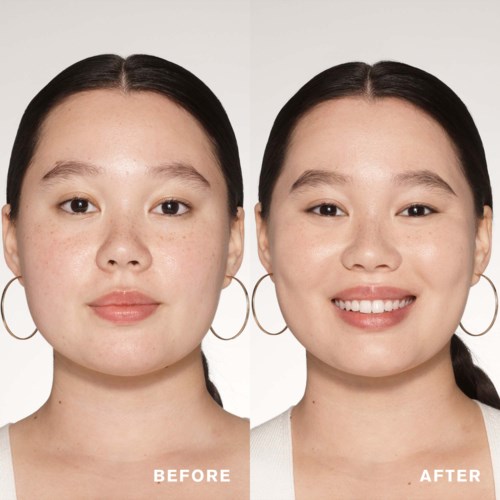 Side-by-side comparison of a woman before and after skincare, showing clearer, smoother skin and a bright smile.