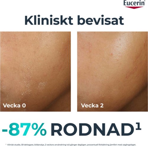To hudbilder viser forbedring fra uke 0 til uke 2 etter bruk av Eucerin. Huden ser klarere og jevnere ut.