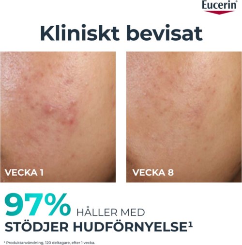 Before and after images show skin improvement, clear of redness and spots, over eight weeks.