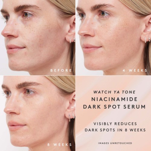 A skincare progress collage showing a woman's face before and after 8 weeks of using niacinamide serum.