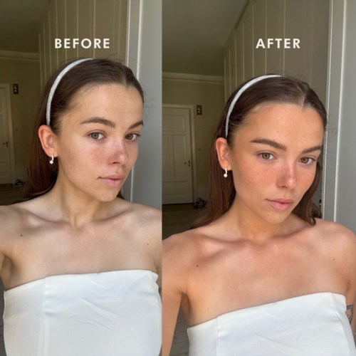 Side-by-side photos showing a woman's face before and after skin improvement, with smoother skin and more even tone.