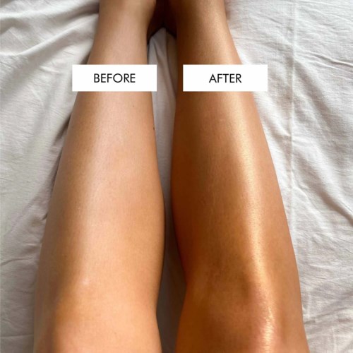Two legs showing before and after skin treatment, with one leg looking shiny and smooth.