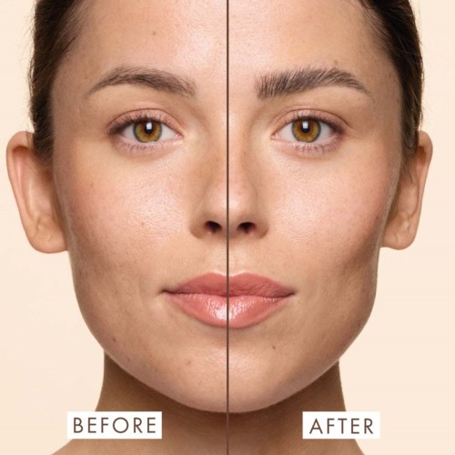 A woman's face shows improved skin clarity and texture after skincare treatment, with smoother skin on the right side.