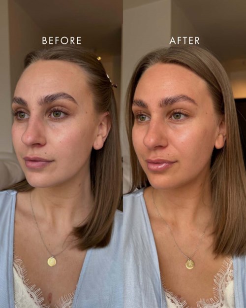 A woman shows a before and after skincare or makeup transformation, with improved skin tone and texture in the second image.
