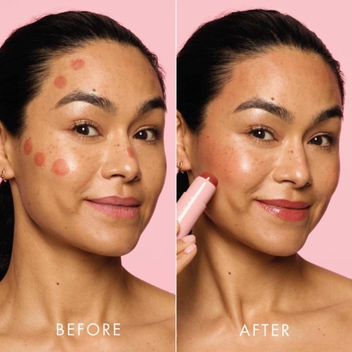 A woman with acne spots visibly cleared up after using a skin product. She has a bright, smooth complexion. Pink background.