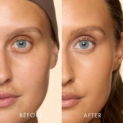 Side-by-side comparison showing skin improvement on face, with clearer, smoother skin after skincare or treatment.