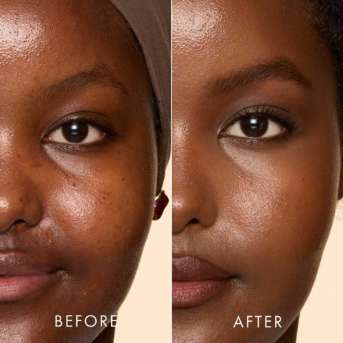 Side-by-side close-up of a woman's face showing skin improvement after treatment.