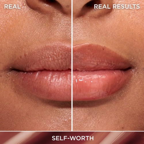 Side-by-side comparison of lips before and after a beauty treatment, showing plumper, more hydrated lips.