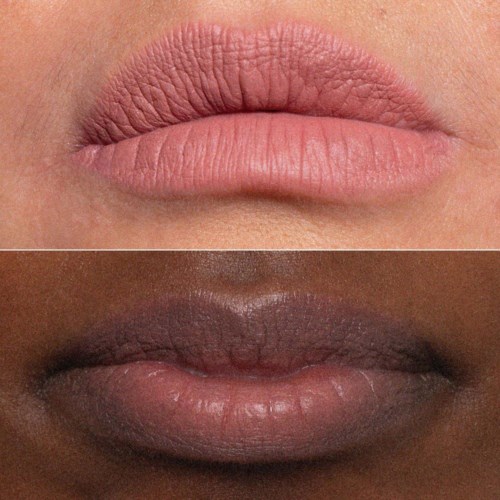 Zwei Lippenpaare, eins hell und trocken, das andere dunkler und feucht.