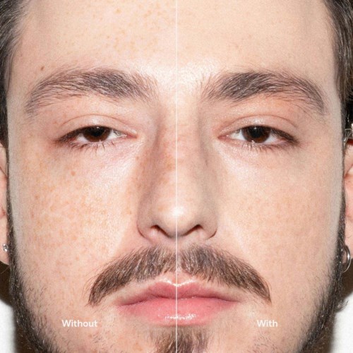 Split image showing a man's face before and after skincare, with clearer, smoother skin on the right side.