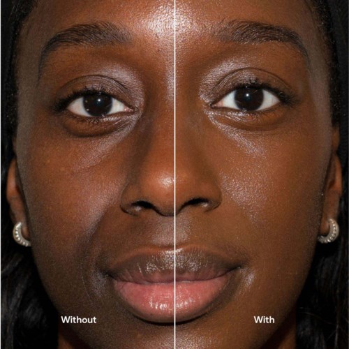 A woman’s face divided into two halves: one side with visible skin issues, the other side smooth and clear.